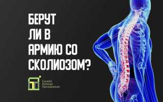 Повлияет ли сколиоз на призыв в армию и условия службы? Где возможно служить с диагнозом сколиоза?