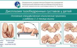 О дисплазии тазобедренных суставов: причины, симптомы и методы лечения