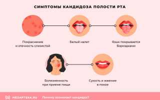 Симптомы и эффективные методы лечения кандидоза в носу