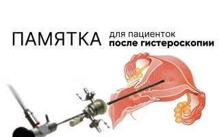 Почему возникают боли в нижней части живота после гистероскопии и как их лечить
