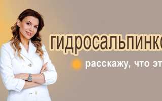 Гидросальпинкс: диагностика, причины и лечение по результатам ультразвукового исследования