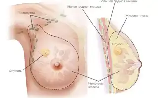 Как предотвратить набухание сосков – причины и методы лечения