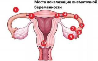Возможно ли зачатие без матки: факты и вымыслы
