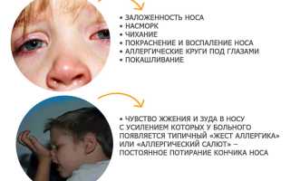 Причины, симптомы и лечение аллергического ринита у детей