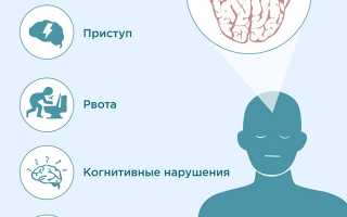 Кондрат: сущность, лечение и причины возникновения.
