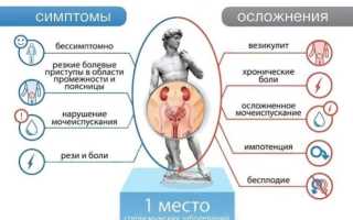 Проблемы с мочеиспусканием при простатите – причины, симптомы, лечение