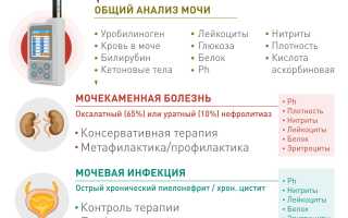 Важная информация о показателе Uro в моче