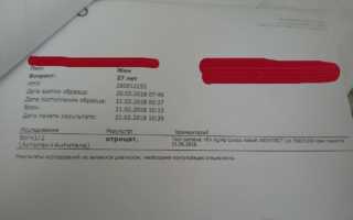 Что такое рэмс-анализ крови и зачем он необходим