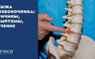 Причины, симптомы и методы лечения грыжи позвоночника – полное руководство