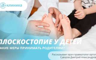 Как определить наличие плоскостопия у ребенка в возрасте 1 год и какие меры нужно принять