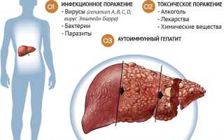 Почему суставы болят при проблемах с печенью и как облегчить симптомы