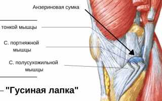 Гусиная лапка коленного сустава: симптомы, причины и методы лечения