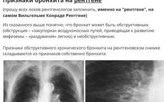 Признаки и симптомы бронхита на флюорографии: внешний вид и диагностические признаки