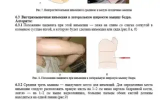 Техника выполнения внутримышечных инъекций: руководство по правильному проведению процедуры