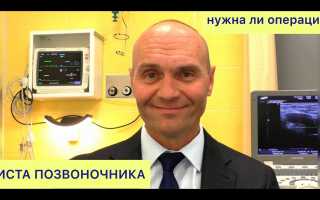 Симптомы, причины и лечение периневральной кисты на уровне S2 позвонка