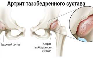 Причины и способы облегчения тянущей боли в паху при беременности