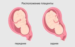 Особенности и важность плаценты на передней стенке матки и шевелений плода