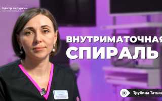 Что нужно знать о стоимости и условиях установки спирали?