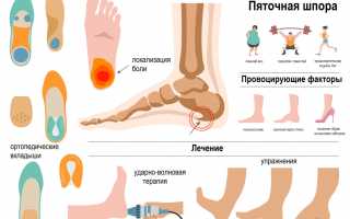 Проблемы с пяткой: симптомы, причины, методы лечения и профилактики пяточной шпоры