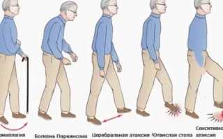 Методы коррекции и основные факторы, вызывающие нарушения координации движений