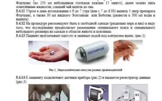 Подготовка пациента к ирригоскопии: основные аспекты и рекомендации