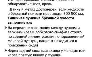 Показания и последствия пункции брюшной полости: основные принципы и важные моменты