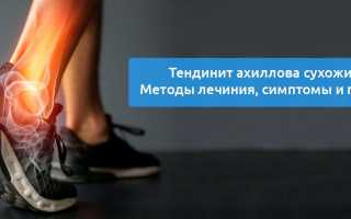 Ахиллов тендинит: причины, симптомы и методы лечения сухожилия