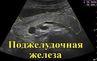 Основные принципы и возможности диагностики узи поджелудочной железы