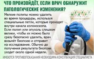 Продолжительность и этапы колоноскопии: все, что нужно знать о процедуре.