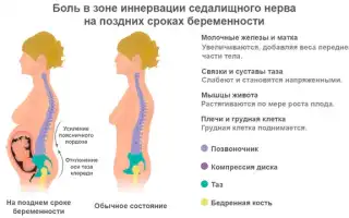 Почему возникают боли во втором триместре беременности, какие симптомы сопровождают их и как лечить неприятные ощущения