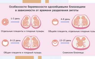 Как определить двойню: сроки и методы определения