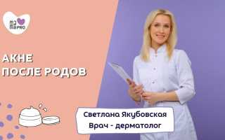 Что вызывает прыщи после родов и как их лечить и предотвращать