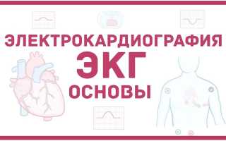 Особенности проведения ЭКГ при декстрокардии: необходимые меры предосторожности и рекомендации