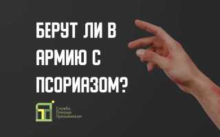Вопросы и ответы о том, как псориаз влияет на призыв в армию