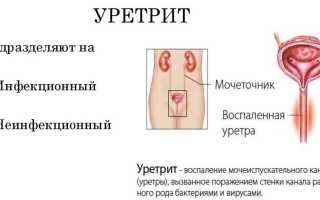 Причины и методы лечения покраснения около мочеиспускательного отверстия у мужчин