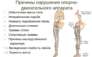Опорно-двигательный аппарат: виды заболеваний, их причины, симптомы и методы лечения