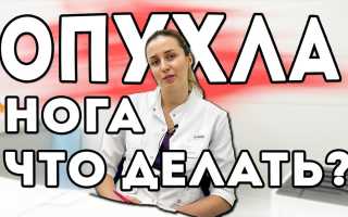 Что делать если опухла и болит нога в районе стопы