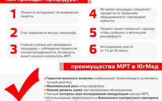 Сколько времени обычно занимает проведение МРТ позвоночника? Подробные сроки и полезные рекомендации.