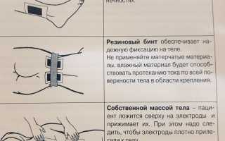 Инструкция по применению электрофореза с гидрокортизоном: правила использования и подробное описание метода