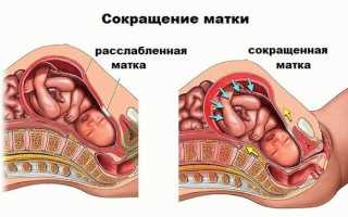 Как распознать разницу между тонусом матки и схватками и что можно сделать в таких случаях