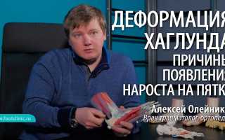 Остеохондропатия пяточной кости: симптомы, причины и эффективные методы лечения