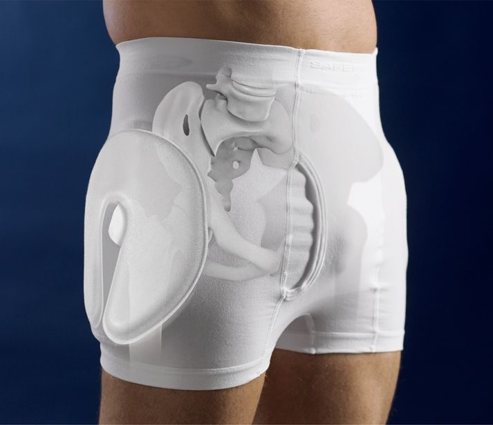 Остеопения шейки бедра