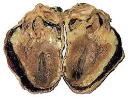 Сердце в разрезе Сердце в разрезе