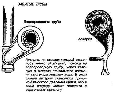 Шпоры и образования в суставах: Тест Брэгга на заизвесткованность