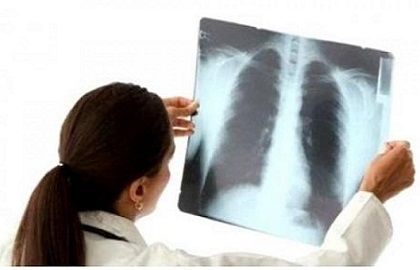 Лечение пневмонии у взрослых