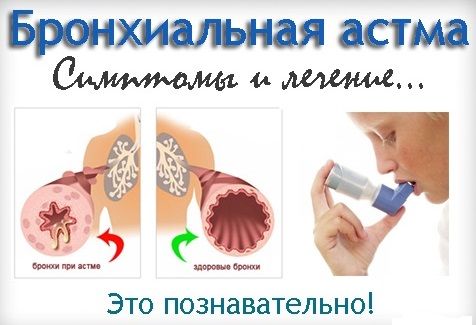 bronhialnaja-astma-simptomy