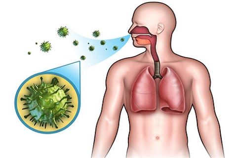 Острая пневмония