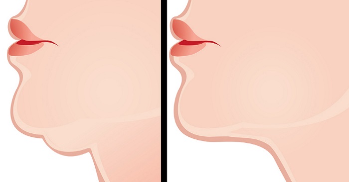 до и после рисунок подбородка