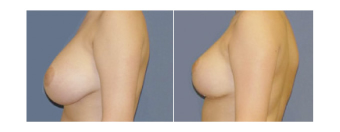 фото до и после