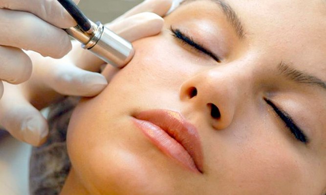 девушке делают микродермабразию